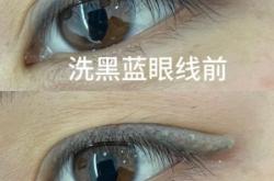 赤峰無創(chuàng)洗眼線電話號(hào)碼是多少