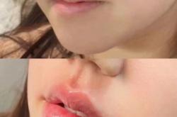 內(nèi)蒙古赤峰豐唇醫(yī)院電話號碼