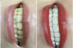 赤峰市牙齒瓷貼面店電話號(hào)碼