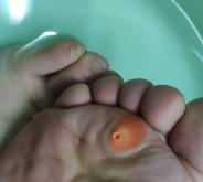 赤峰市修雞眼電話是多少號(hào)