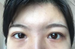 赤峰開(kāi)眼角醫(yī)生電話(huà)號(hào)碼是多少