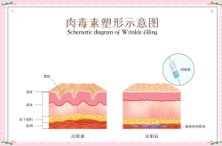 赤峰肉毒團(tuán)購(gòu)電話地址查詢