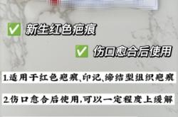 赤峰凹陷修復(fù)公司排名