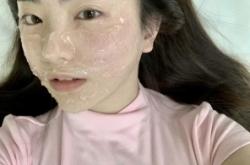 赤峰光子嫩膚上門電話號碼是多少