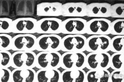 赤峰城東腫瘤醫(yī)院電話號碼