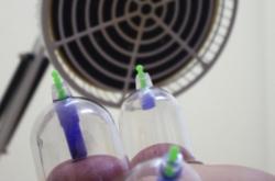 赤峰市中醫(yī)針灸診所電話號(hào)碼