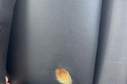 赤峰煙頭燙傷修復(fù)店電話號碼