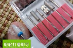 赤峰修灰指甲電話(huà)多少號(hào)