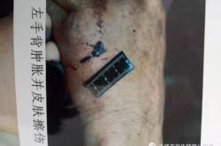 赤峰法醫(yī)鑒定平臺(tái)電話號(hào)碼