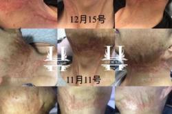 赤峰汽車地毯燙傷修復電話號碼