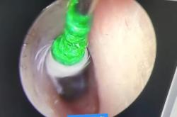 赤峰掏耳鏡維修電話號(hào)碼是多少