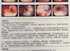 赤峰二醫(yī)院胃鏡室電話號碼