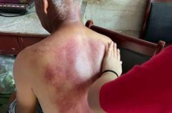 赤峰張家按摩店電話號碼多少