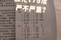 赤峰市視力矯正醫(yī)院電話號碼