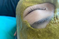 赤峰祛疣祛痘醫(yī)院電話號碼