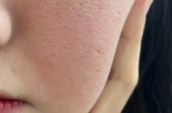 赤峰清潔毛孔團(tuán)購地址電話號碼