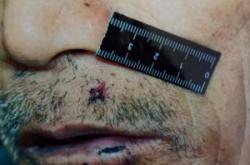 赤峰市法醫(yī)鑒定電話號碼