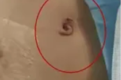 赤峰市小兒外科醫(yī)院電話號碼