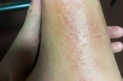 赤峰水泡子轉(zhuǎn)租電話多少號(hào)