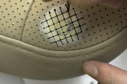 赤峰煙頭燙傷修復(fù)醫(yī)院電話號碼