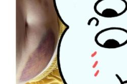 赤峰市婦產(chǎn)醫(yī)院抽血電話號碼