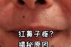 赤峰肌膚醫(yī)生加盟店電話號碼