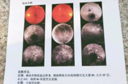 赤峰市醫(yī)院眼科電話號(hào)碼是多少