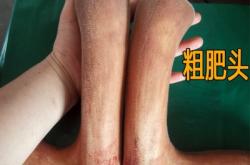 赤峰有粉碎鹿茸店嗎電話號(hào)碼