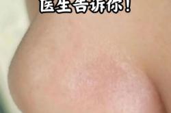 赤峰肌膚醫(yī)生電話多少啊