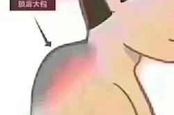 赤峰新城肩頸疏通店電話號(hào)碼