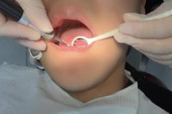 赤峰哪里弄牙比較好