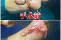 赤峰痛風(fēng)康復(fù)中心電話多少號