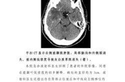 赤峰第二醫(yī)院癲癇科電話號碼