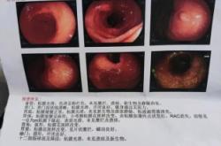 赤峰市于生志胃病電話