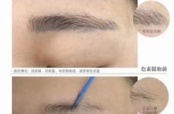 赤峰市無創(chuàng)洗眼線電話號碼