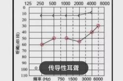 赤峰市耳朵聽力檢測機(jī)構(gòu)電話號碼