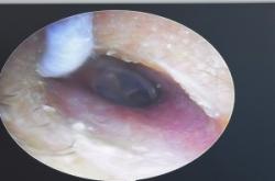 赤峰首耳采耳店電話地址查詢(xún)