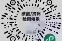 赤峰抗體檢測站電話號碼是多少