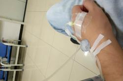 赤峰市二醫(yī)院輸液室電話號碼