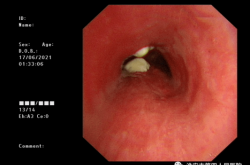 赤峰市支氣管鏡醫(yī)院電話號(hào)碼