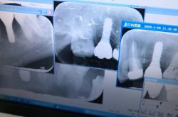 赤峰錦美口腔連鎖電話(huà)多少號(hào)