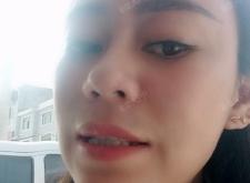 赤峰市冷光美白地址電話號(hào)碼