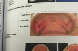赤峰精翼義齒加工廠電話號碼