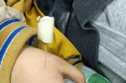 赤峰市針灸診所電話號(hào)碼查詢