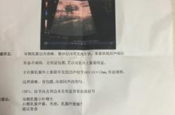 赤峰腫瘤醫(yī)院七樓電話號(hào)碼