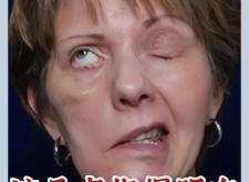 赤峰肉毒團購電話地址查詢