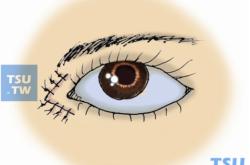 赤峰肌肉松解劑廠家電話號碼