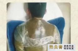 赤峰熱灸膏廠家電話號碼