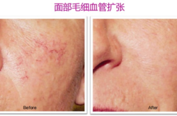 赤峰全身美白醫(yī)院電話號碼是多少