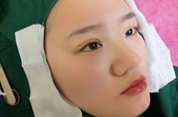 赤峰納米無痕修復(fù)廠家電話號碼